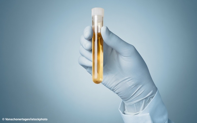 Du betrachtest gerade Hauptursache Sonnencreme: Kinder mit verbotenen Weichmachern belastet